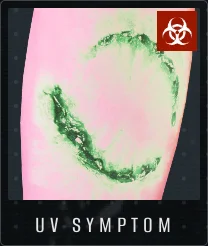 UV Symptom